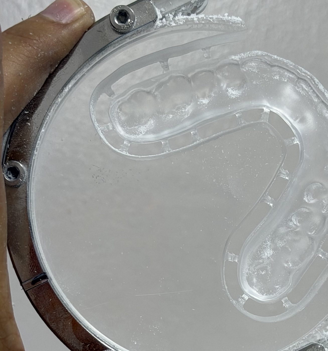 Guarda oclusal fresada — Laboratorio Dental NIX