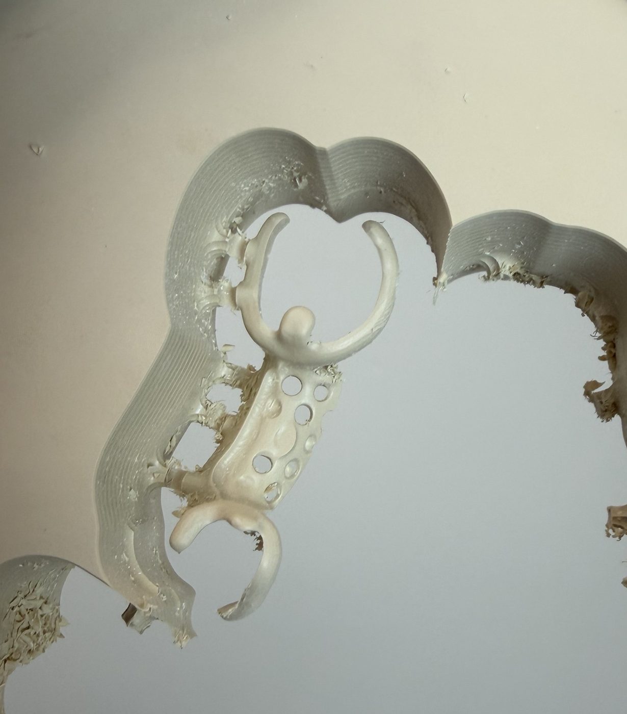 Estructura de removible fresada en PEEK — Laboratorio Dental NIX