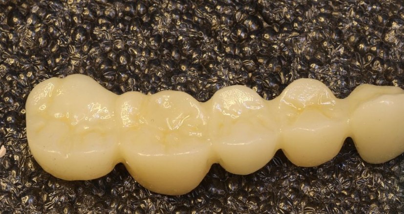 Puente de zirconia